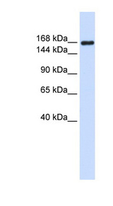 LAMC1 / Laminin Gamma 1 antibody LS-C112171 Western blot of Placenta lysate.