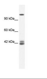 Jurkat Cell Lysate