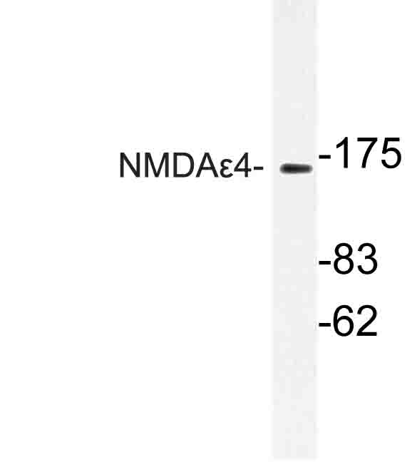 Western blot of NMDA4 (P706) pAb in extracts from COS-7 cells.