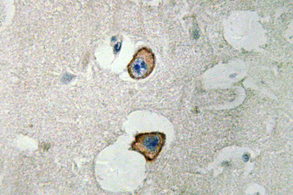 IHC of NMDA4 (L693) pAb in paraffin-embedded human brain tissue.
