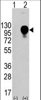 Western blot of LAMP2 (arrow) using LAMP2 Antibody. 293 cell lysates (2 ug/lane) either nontransfected (Lane 1) or transiently transfected with the LAMP2 gene (Lane 2) (Origene Technologies). Mature, functional LAMP2 is extensively glycosylated with a variety of different N linked and O linked oligosaccharides with a total molecular weight of ~100-110 kDa.