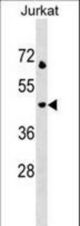 LAMP3 Antibody western blot of Jurkat cell line lysates (35 ug/lane). The LAMP3 antibody detected the LAMP3 protein (arrow).