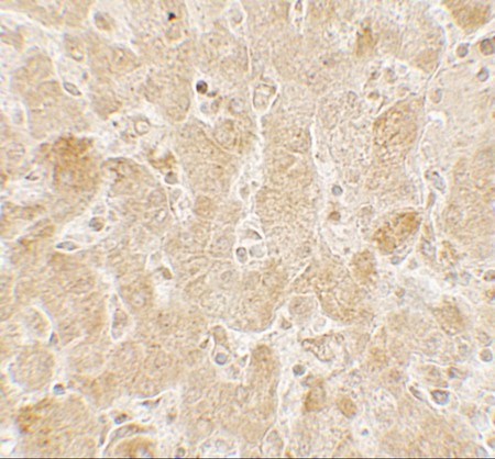 Immunohistochemistry of LAMTOR2 in human spleen tissue with LAMTOR2 antibody at 5 ug/mL.