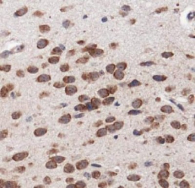 Immunohistochemistry: MAP2K1IP1/MAPKSP1 Antibody - IHC of MAP2K1IP1 in mouse lung.