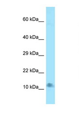 0910001L09Rik antibody LS-C146520 Western blot of Mouse Heart lysate. Antibody concentration 1 ug/ml.