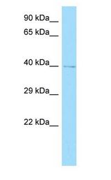 GRINA antibody Western Blot of NCI-H226 cell lysate.