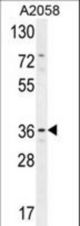 GRINA Antibody western blot of A2058 cell line lysates (35 ug/lane). The GRINA antibody detected the GRINA protein (arrow).