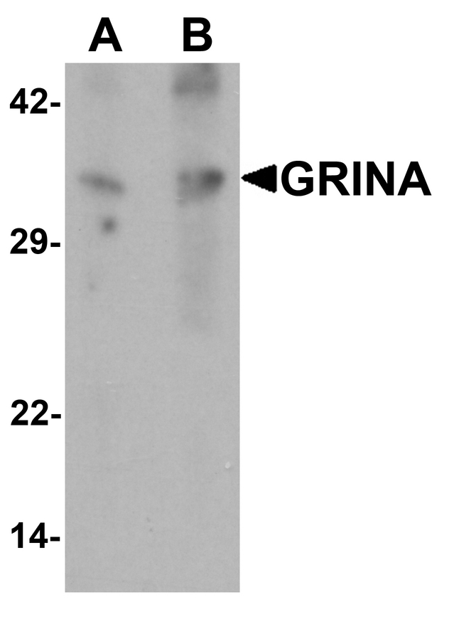Western blot analysis of GRINA in human testis tissue lysate with GRINA antibody at (A) 1 and (B) 2 ug/ml.