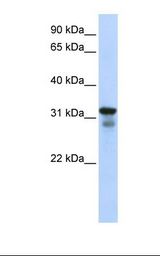 293T cell lysate. Antibody concentration: 1.0 ug/ml. Gel concentration: 12%.