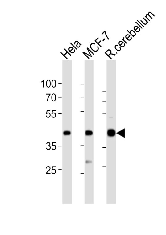 Western blot of lysates from HeLa, MCF-7 cell line, rat cerebellum tissue lysate (from left to right) with LAPTM4B Antibody (4). Antibody was diluted at 1:1000 at each lane. A goat anti-rabbit IgG H&L (HRP) at 1:10000 dilution was used as the secondary antibody. Lysates at 20 ug per lane.