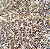 LAPTM5 antibody immunohistochemistry of formalin-fixed and paraffin-embedded human lymph node followed by peroxidase-conjugated secondary antibody and DAB staining.
