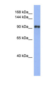 LARP1 / LARP antibody LS-C107499 Western blot of Fetal Stomach lysate.