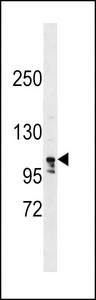 LARP1B Antibody western blot of ZR-75-1 cell line lysates (35 ug/lane). The LARP1B antibody detected the LARP1B protein (arrow).