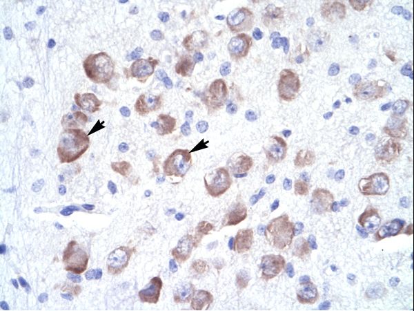 LARP1B / LARP2 antibody LS-C31469 was used in IHC to stain formalin-fixed, paraffin-embedded human brain.