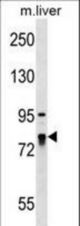 LARP4 Antibody western blot of mouse liver tissue lysates (35 ug/lane). The LARP4 antibody detected the LARP4 protein (arrow).