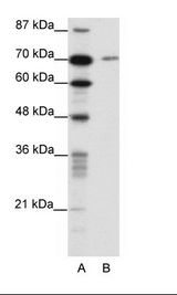 A: Marker, B: HepG2 Cell Lysate