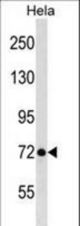 LAS1L Antibody western blot of HeLa cell line lysates (35 ug/lane). The LAS1L antibody detected the LAS1L protein (arrow).