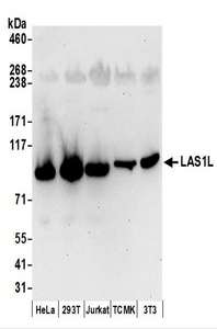 Detection of Human and Mouse LAS1L by Western Blot. Samples: Whole cell lysate (50 ug) prepared using NETN buffer from HeLa, 293T, Jurkat, mouse TCMK-1, and mouse NIH3T3 cells. Antibodies: Affinity purified rabbit anti-LAS1L antibody used for WB at 0.1 ug/ml. Detection: Chemiluminescence with an exposure time of 30 seconds.