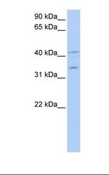 MCF7 cell lysate. Antibody concentration: 1.0 ug/ml. Gel concentration: 12%.