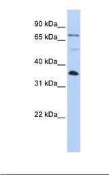 HepG2 cell lysate. Antibody concentration: 1.0 ug/ml. Gel concentration: 12%.