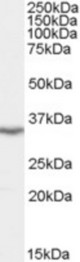 Antibody staining (0.1 ug/ml) of Human Brain (Cerebellum) extracts (RIPA buffer, 35 ug total protein per lane). Primary incubated for 1 hour. Detected by Western blot of chemiluminescence.