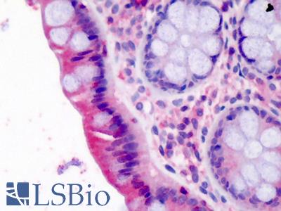 Anti-LASP1 antibody IHC of human colon. Immunohistochemistry of formalin-fixed, paraffin-embedded tissue after heat-induced antigen retrieval. Antibody LS-B4765 concentration 2.5 ug/ml.