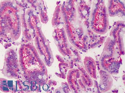 Anti-LASP1 antibody IHC of human small intestine. Immunohistochemistry of formalin-fixed, paraffin-embedded tissue after heat-induced antigen retrieval. Antibody LS-B4765 concentration 2.5 ug/ml.