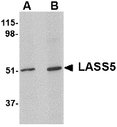 Western blot of LASS5 in SK-N-SH lysate with LASS5 antibody at (A) 1 and (B) 2 ug/ml