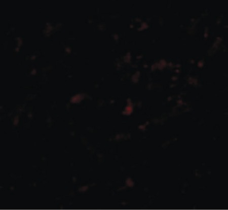 Immunofluorescence of LASS5 in Human Brain cells with LASS5 antibody at 20 ug/ml.