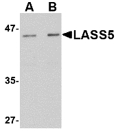 Western blot of LASS5 in rat brain tissue lysate with LASS5 antibody at (A) 1 and (B) 2 ug/ml.