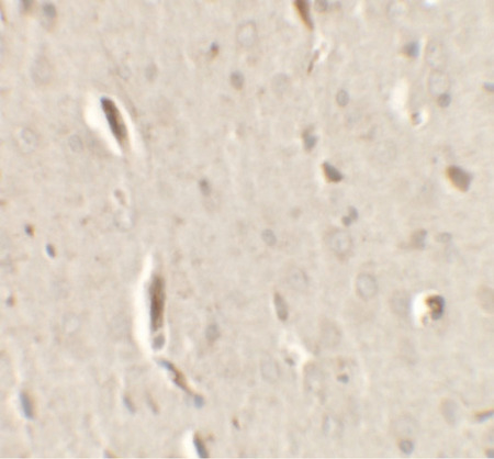 Immunohistochemistry of GRIP1 in rat brain tissue with GRIP1 antibody at 2.5 ug/ml.