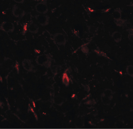 Immunofluorescence of GRIP1 in rat brain tissue with GRIP1 antibody at 20 ug/ml.