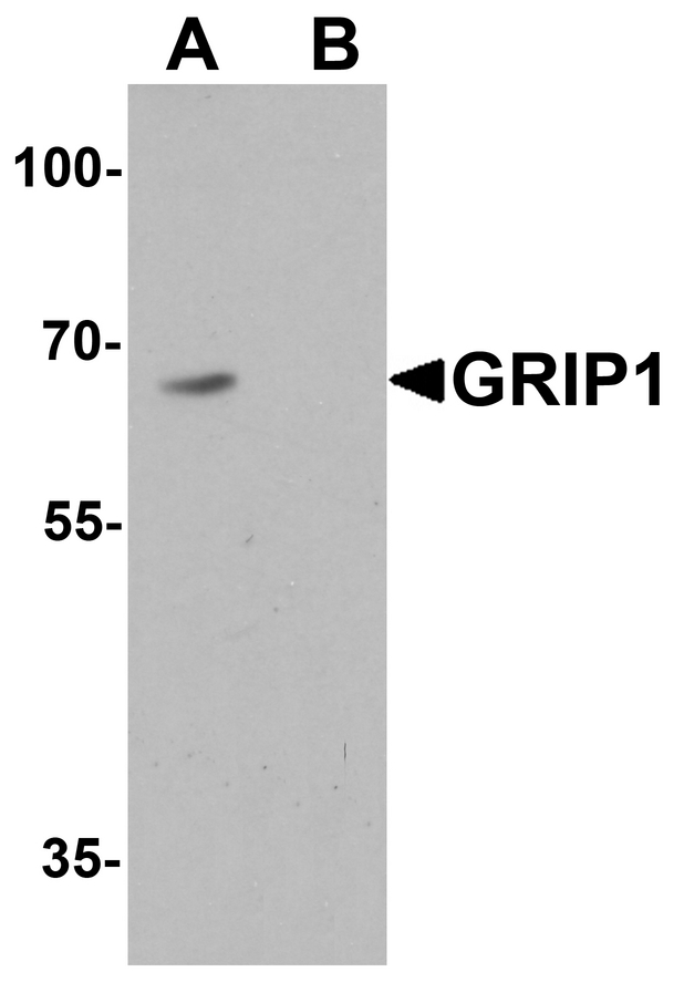 Western blot analysis of GRIP1 in HeLa cell lysate with GRIP1 antibody at 1 ug/ml in (A) the absence and (B) the presence of blocking peptide.