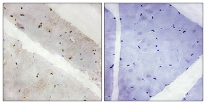 IHC of paraffin-embedded human skeletal muscle tissue, using LATS2 Antibody. The sample on the right was incubated with synthetic peptide.