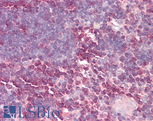 Anti-LBR / Lamin B Receptor antibody IHC of human thymus. Immunohistochemistry of formalin-fixed, paraffin-embedded tissue after heat-induced antigen retrieval. Antibody LS-B8099 dilution 5-10 ug/ml.