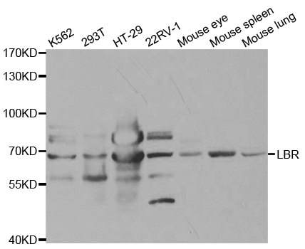 Western blot analysis of extracts of various cell lines, using LBR antibody.
