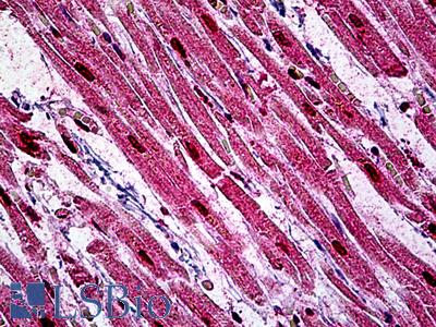 Anti-LBR antibody IHC of human heart. Immunohistochemistry of formalin-fixed, paraffin-embedded tissue after heat-induced antigen retrieval. Antibody LS-B5128 concentration 2.5 ug/ml.
