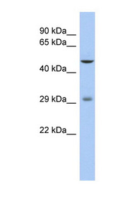 LBX1 antibody LS-C109715 Western blot of Fetal Thymus lysate.
