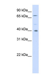SPATA7 antibody LS-C102722 Western blot of 293T cell lysate.