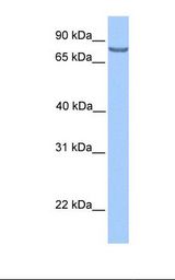 HepG2 cell lysate. Antibody concentration: 1.0 ug/ml. Gel concentration: 12%.