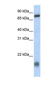 LCA5L / C21orf13 antibody LS-C102198 Western blot of MCF7 cell lysate.