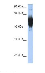 Transfected 293T cell lysate. Antibody concentration: 1.0 ug/ml. Gel concentration: 12%.
