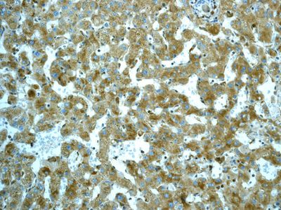 IHC of paraffin-embedded human liver tissue using anti-LCAT antibody.