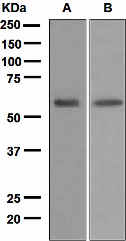 Western blot analysis on (A) human serum and (B) human plasma lysates using anti-LCAT antibody.