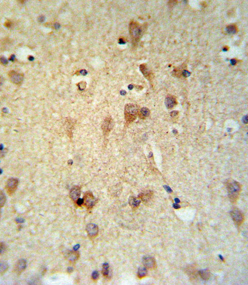 LCAT Antibody IHC of formalin-fixed and paraffin-embedded brain tissue followed by peroxidase-conjugated secondary antibody and DAB staining.