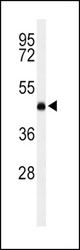 Western blot of LCAT Antibody in K562 cell line lysates (35 ug/lane). LCAT (arrow) was detected using the purified antibody.