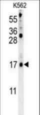 LCE2B Antibody western blot of K562 cell line lysates (35 ug/lane). The LCE2B antibody detected the LCE2B protein (arrow).