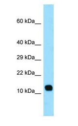 LCE3C antibody Western Blot of Fetal Lung.