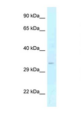 GOLPH3 antibody LS-C145732 Western blot of Fetal Liver lysate. Antibody concentration 1 ug/ml.