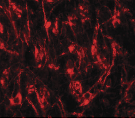 Immunofluorescence of TYW1 in mouse brain tissue with TYW1 antibody at 20 ug/ml.